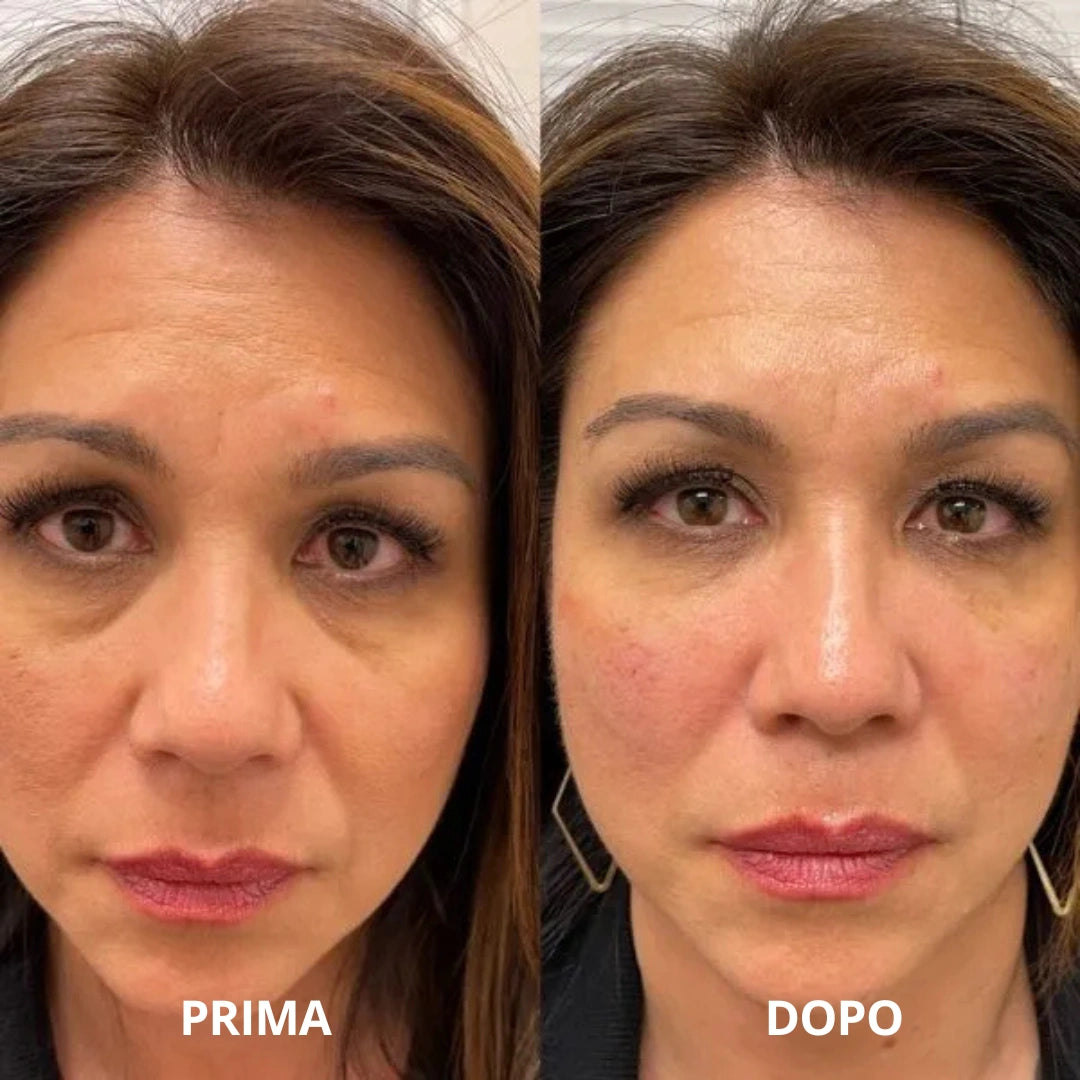 Patch occhi in idrogel al collagene e peptidi