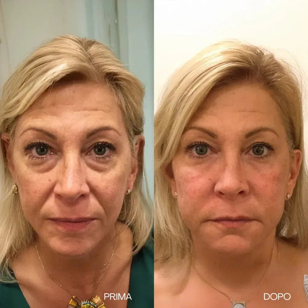 Crema antirughe Instant V-Lift