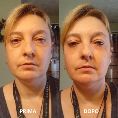 Patch occhi in idrogel al collagene e peptidi